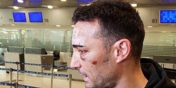 Lionel Scaloni, al aterrizar en el aeropuerto de Ezeiza luego del accidente que sufrió en Mallorca\u002E
