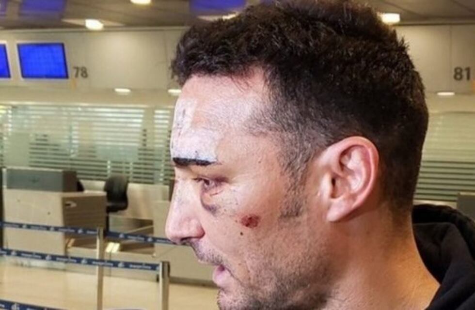 Lionel Scaloni regresó al país tras el accidente con un auto: "Me lo comí entero"