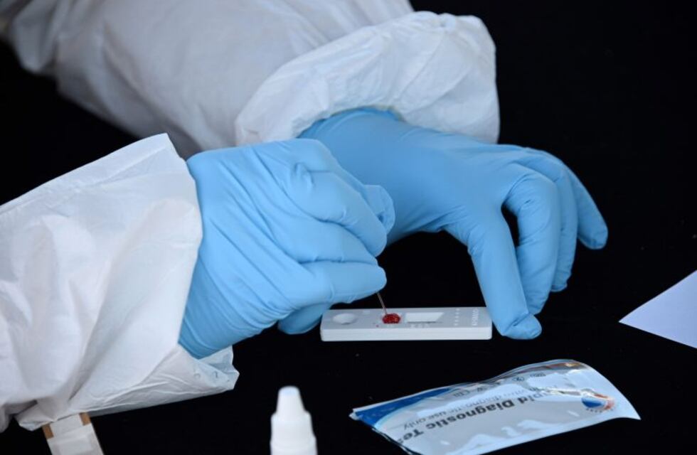 Un estudio afirma que la inmunidad desarrollada contra el coronavirus decae rápido