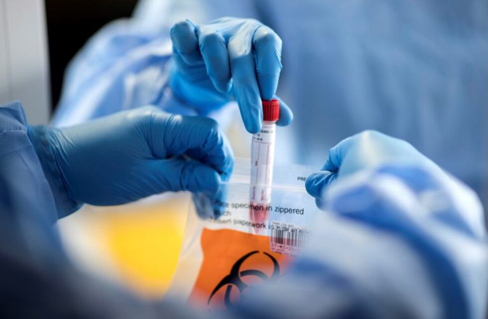 Se confirmaron nuevos casos de coronavirus en Loncopué