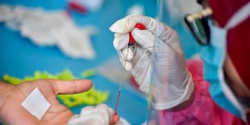 Coronavirus Test\u002E