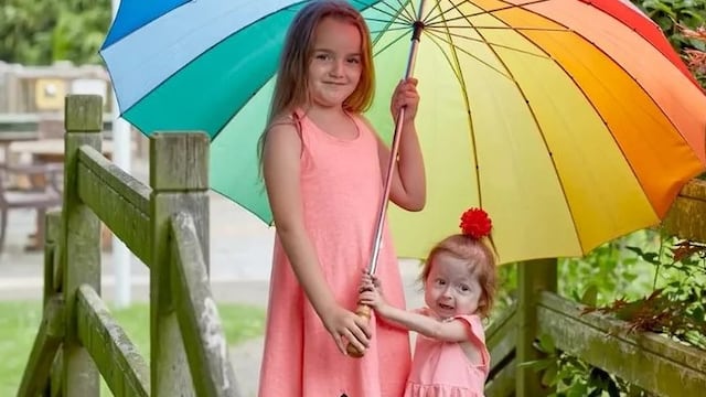 El curioso caso de una nena de dos años que aparenta físicamente tener 80