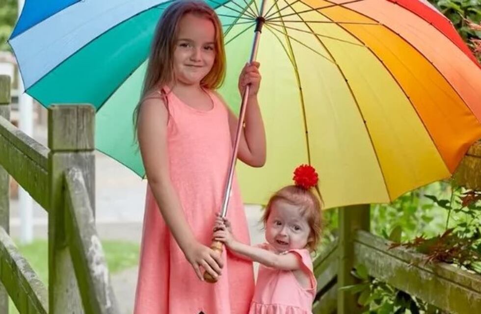 El curioso caso de una nena de dos años que aparenta físicamente tener 80