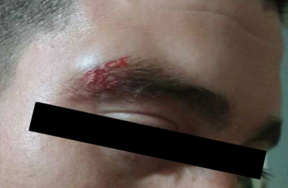 Denuncian a la Policía por dos brutales golpizas a jóvenes en plena calle