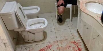 Brutal fue la golpiza que recibió el árbitro Amiconi en Pergamino\u002E (TN)