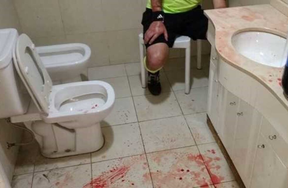 Feroz golpiza a un árbitro en Pergamino: sufrió severos cortes en la cabeza