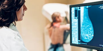 19 de octubre: Día contra el cáncer de mama. (Freepik)