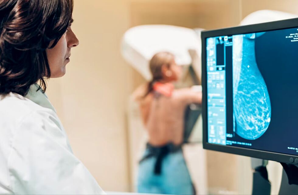 Punta Alta: campaña de Detección Precoz de Cáncer de Mama