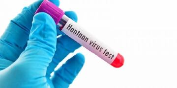 Muestra Hantavirus