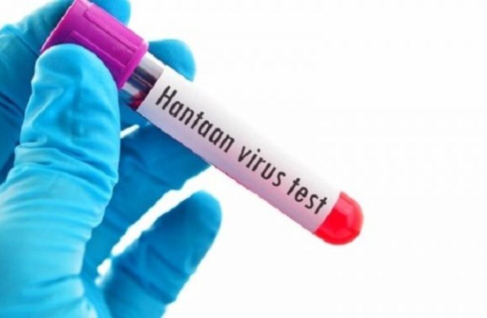 Confirmaron el primer caso autóctono de Hantavirus en el Departamento Gualeguaychú