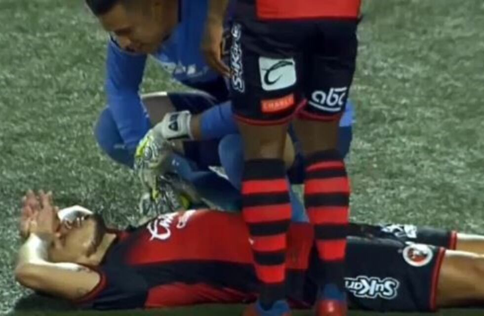 La impactante lesión que sufrió Gustavo Bou en México