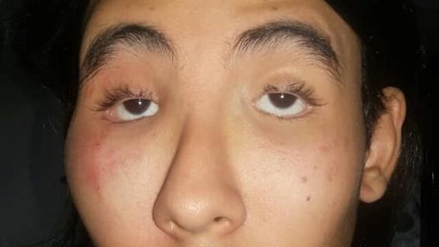 El menor quedó desfigurado luego de ser alojado en las seccionales 14 y 32\u002E (Facebook)