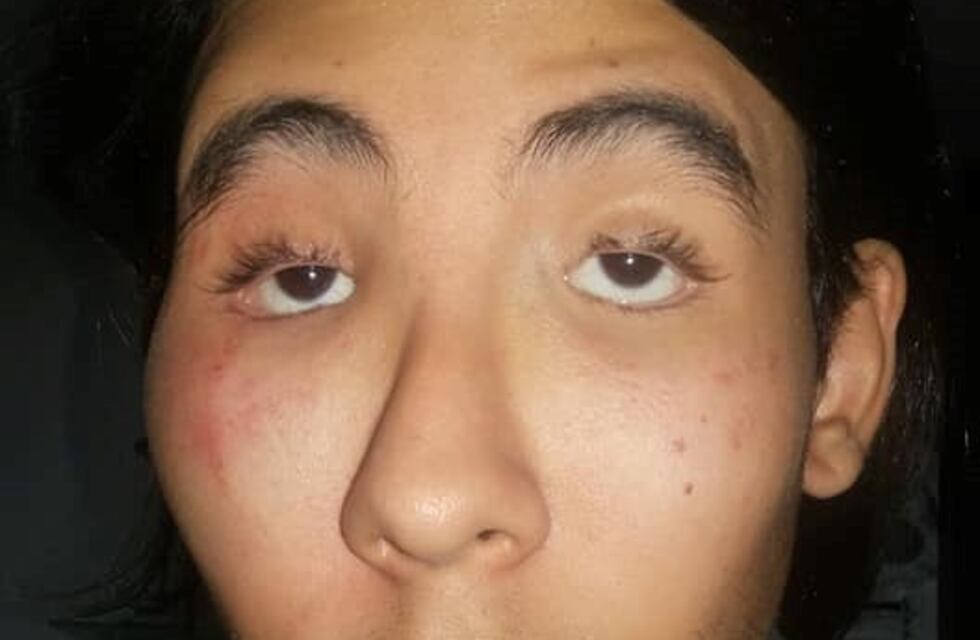 Un adolescente denunció que la policía lo golpeó y lo detuvo "por zurdo"