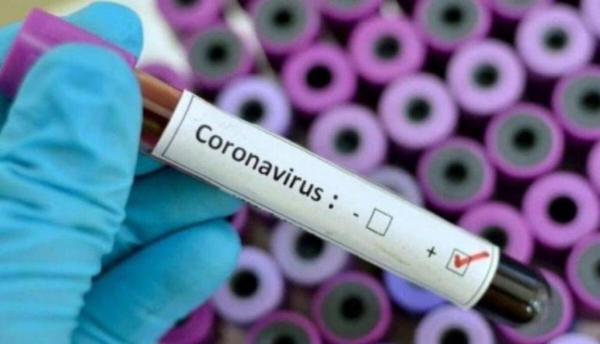 Un nuevo caso de Coronavirus en Corrientes\u002E