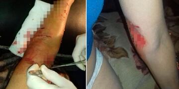 Ataques de perros a una mujer en Alta Gracia\u002E