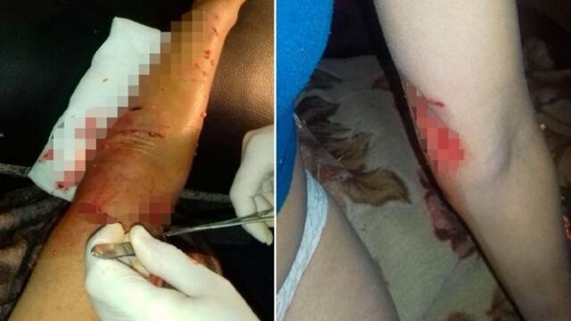 Ataques de perros a una mujer en Alta Gracia\u002E