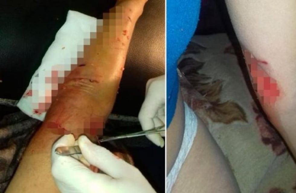 Un salvaje ataque de perros dejó gravemente herida a una mujer en Alta Gracia