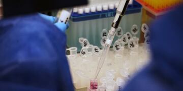 A pharmaceutical biochemist neutralizes and separates genetic material from a SARS-CoV-2 test at a laboratory at the Autonomous University of San Luis Potosi (UASLP) Research Center in Health Sciences and Biomedicine in San Luis Potosi, Mexico, on Friday, July 24, 2020\u002E The number of confirmed cases in the coronavirus outbreak in Mexico stands at 395,489 and the number of fatalities is 44,022 as of 7:30am Mexico City, according to data collected by Johns Hopkins University and Bloomberg News\u002E Photographer: Mauricio Palos/Bloomberg