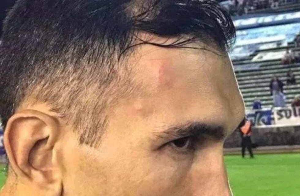 Suspendieron un partido de Copa Argentina por la agresión a un juez de línea