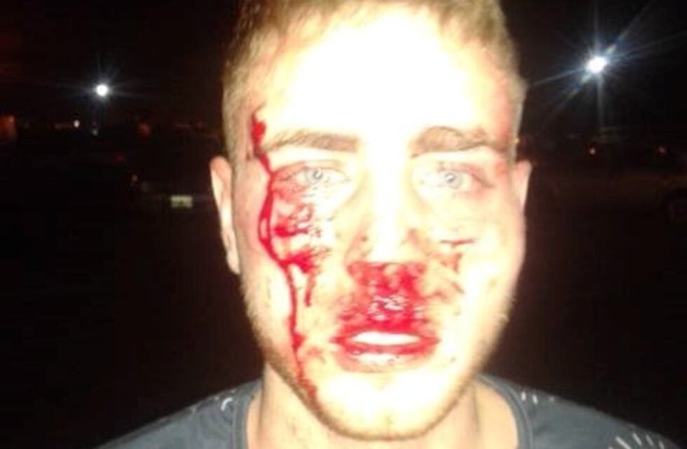 Fue a un conocido complejo bailable y denunció que los patovicas lo golpearon salvajemente