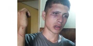 joven agredido por policía