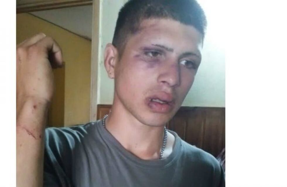 Denunció que fue brutalmente golpeado por la policía en medio de una persecución