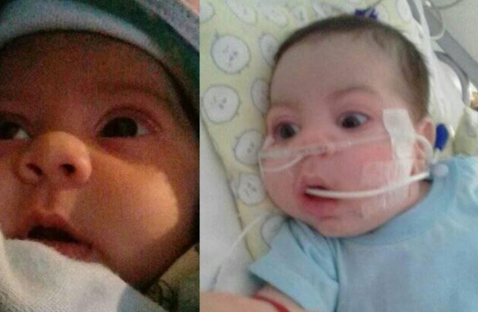 La peor pesadilla de un padre: nació sano, y tras una bronquiolitis quedó discapacitado