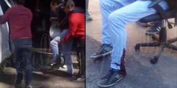 El delincuente le disparó en el tobillo izquierdo\u002E