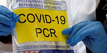 This picture taken on October 28, 2020, in the biosafety level 2 laboratory Biomnis in Ivry-sur-Seine, near Paris, shows a bag to transport test tube of a sample to be analysed with PCR method to detect the Covid-19 novel coronavirus\u002E (Photo by Ludovic MARIN / AFP)