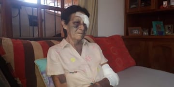 Colonia Victoria: golpearon salvajemente a una anciana de 77 años