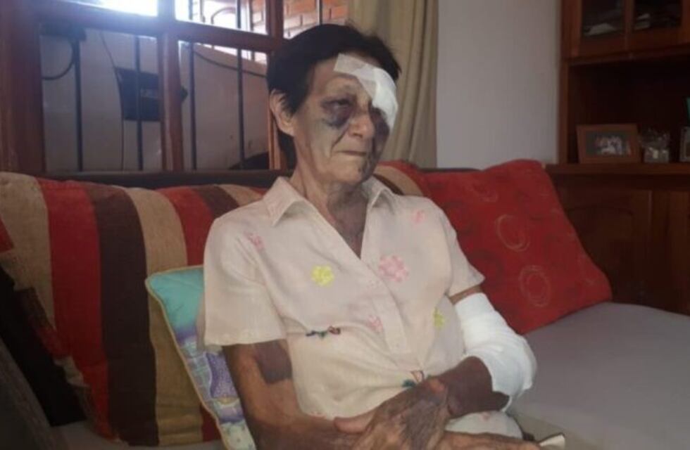 Colonia Victoria: golpearon salvajemente a una anciana de 77 años
