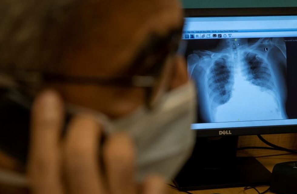 Murieron seis personas por coronavirus y Santa Fe acumula 144 fallecidos