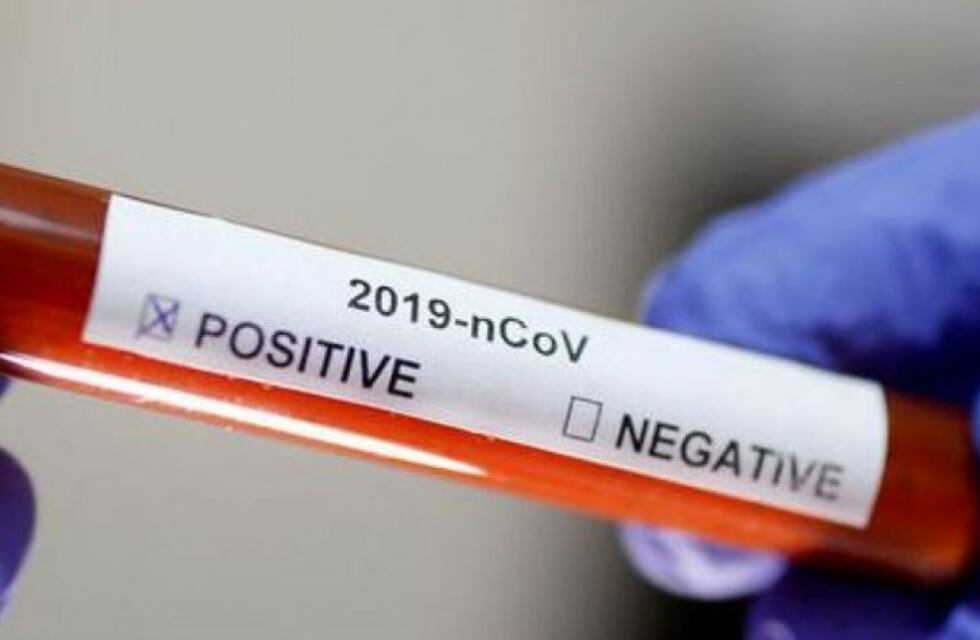 Aparecieron 5 nuevos casos positivos de COVID-19