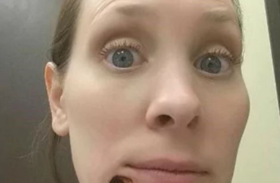 Pensó que era un grano pero se trataba de un cáncer de piel