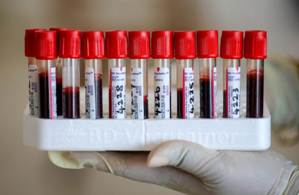 Coronavirus en La Rioja: tres fallecidos y 169 casos positivos