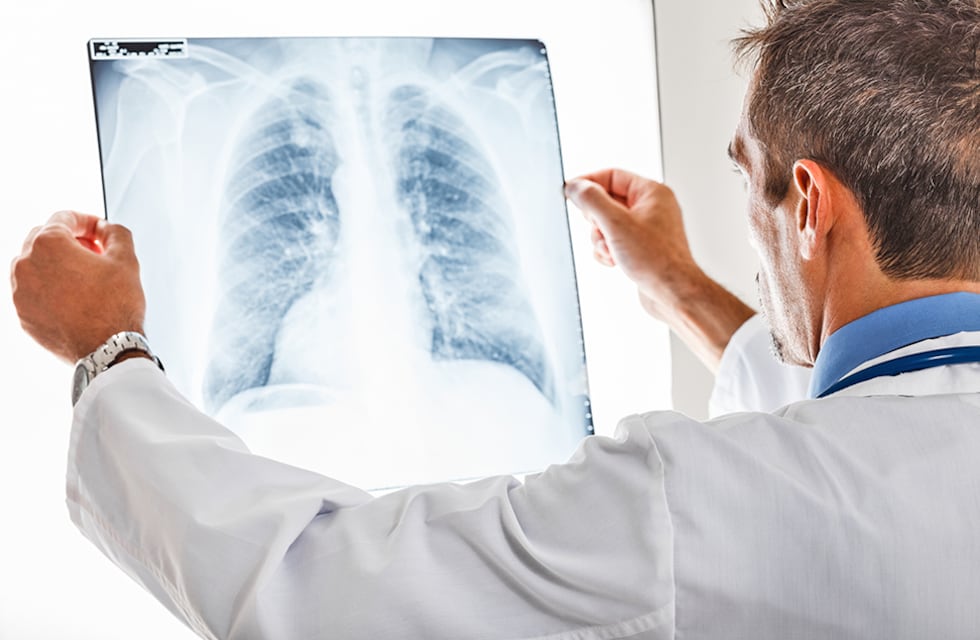 En 2020 el diagnóstico de cáncer se redujo en un 40% a nivel mundial por la pandemia