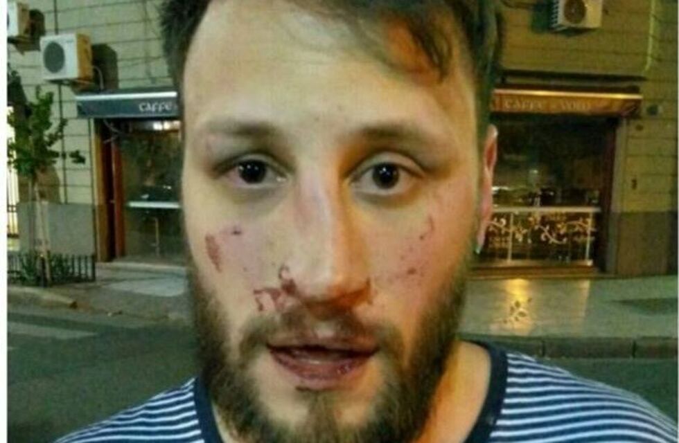 Denuncian que estudiantes socialistas en Derecho golpearon a un ex militante de la Cámpora