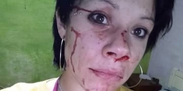 La golpeó, la dejó inconsciente y escapó: detuvieron a un azuleño por violencia de género