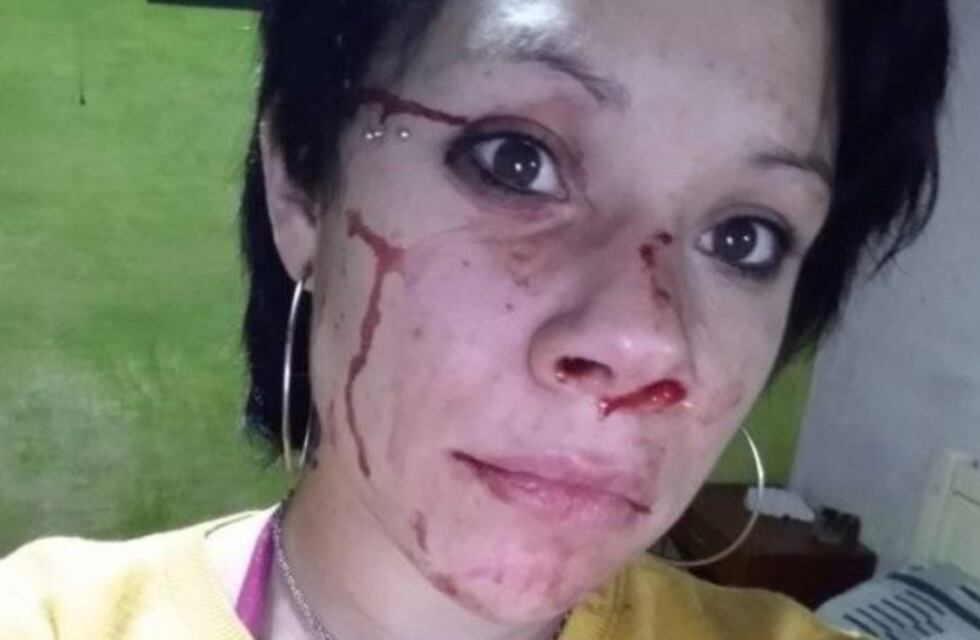 La golpeó, la dejó inconsciente y escapó: detuvieron a un azuleño por violencia de género