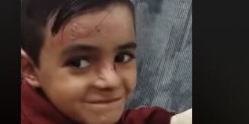 Juampi Gaetán, el niño con piel de cristal