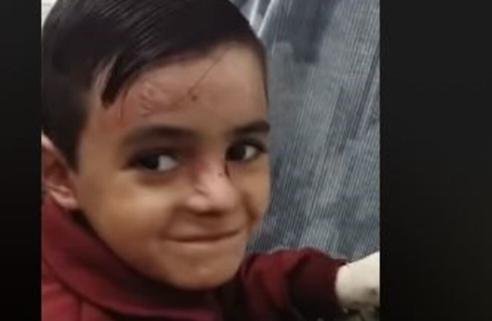 El niño que padece epidermólisis bullosa o piel de cristal toca el piano en la Escuela Vélez Sarsfield de Arroyito