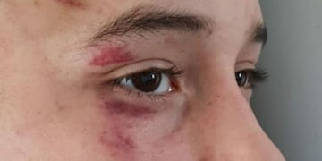Denuncia abuso policial en Ushuaia\u002E Fotos: La Garganta Poderosa\u002E