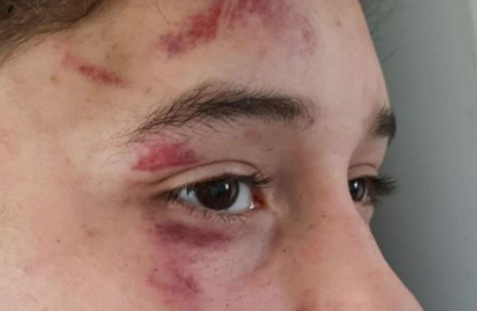 Ushuaia: denuncian abuso policial y torturas