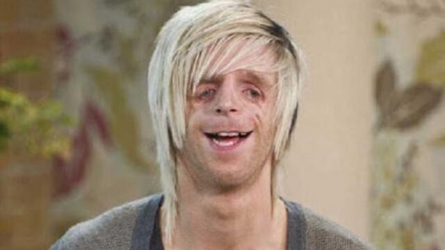 Deformidad al nacer.