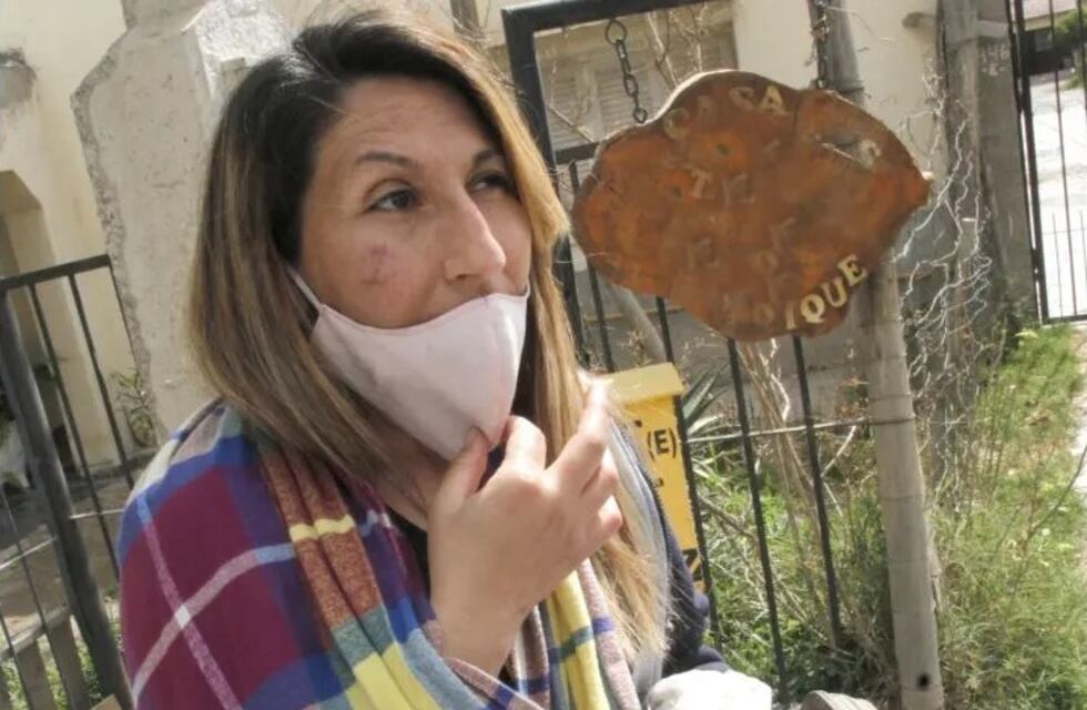 El drama de una hockista sanjuanina que se fracturó el hombro por un ataque de motochorros