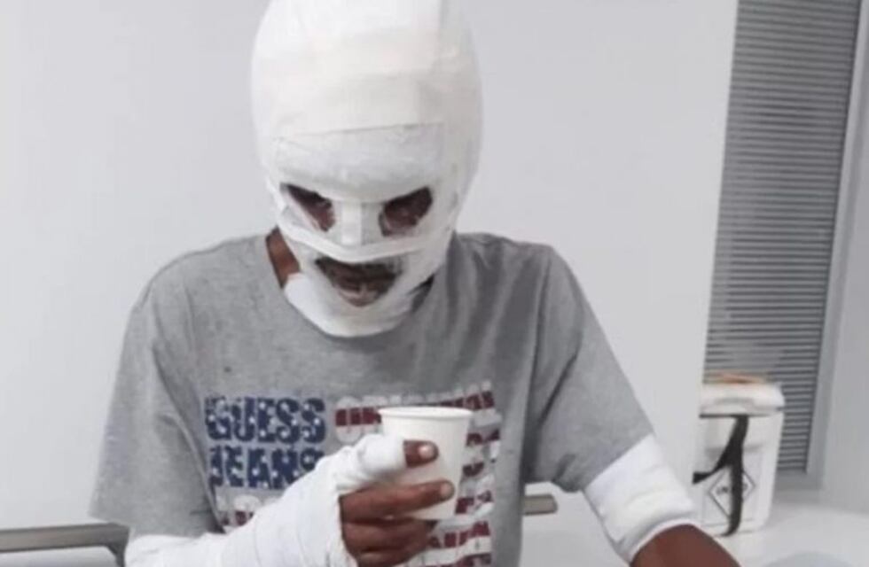 Un hombre resultó herido tras arriesgar su vida por salvar la de ocho perros