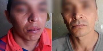 Presos mendocinos se cocieron la boca