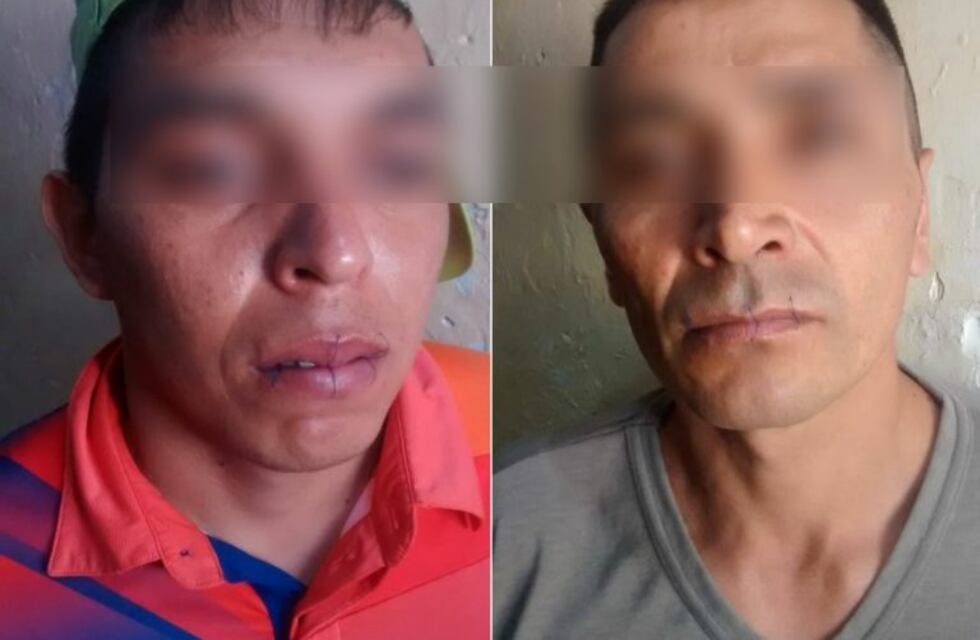 Huelga de hambre: presos mendocinos se cosieron la boca