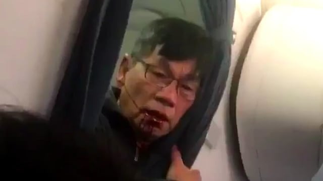 David Dao, el pasajero expulsado de un vuelo de UA.