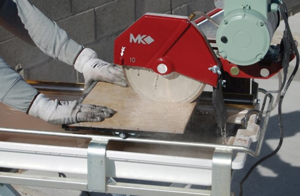 Perdió la mano con una sierra y cobrará una indemnización millonaria